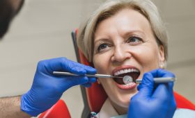 Germany Dental Veneers