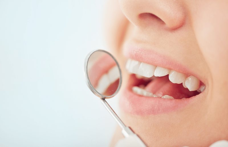 Dental Treatment in Greece