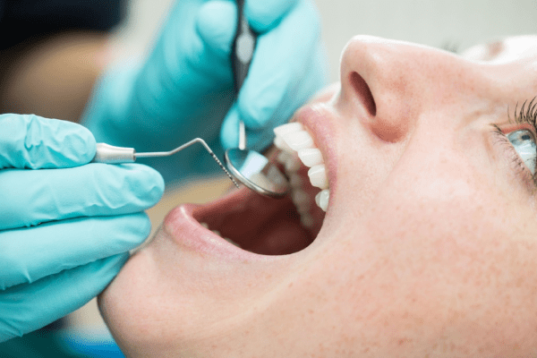 Dental Veneers in Bulgaria