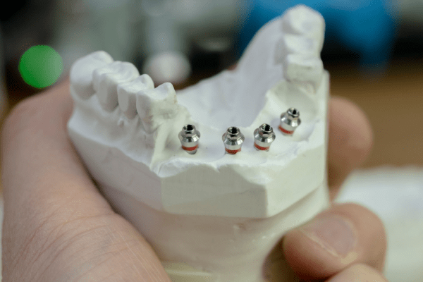 Bulgaria - Turkey Dental Implant