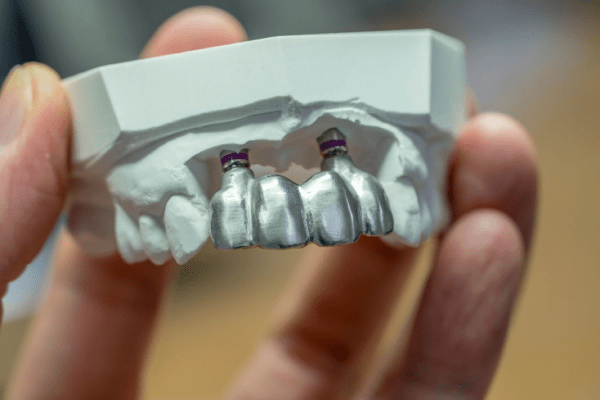 Kusadasi All On Six Dental Implant 