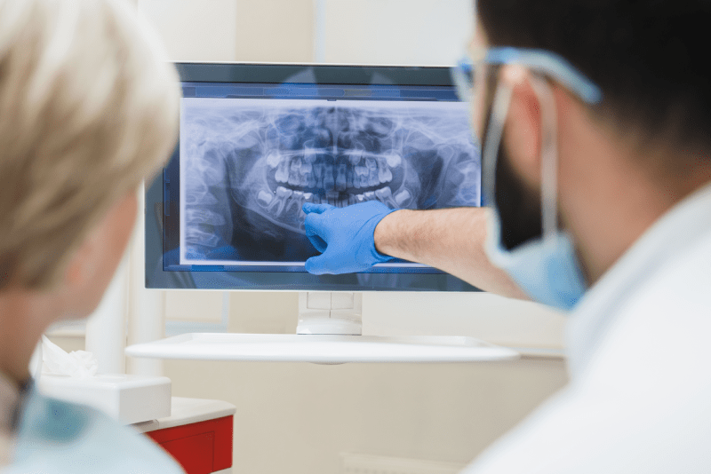 Dental Implant Surgery in Kusadasi