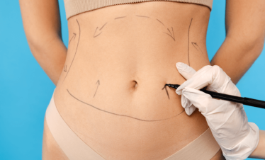 Liposuction prices in Turkey