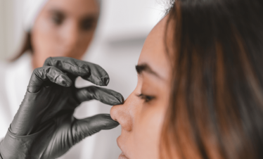 Rhinoplasty in Turkey